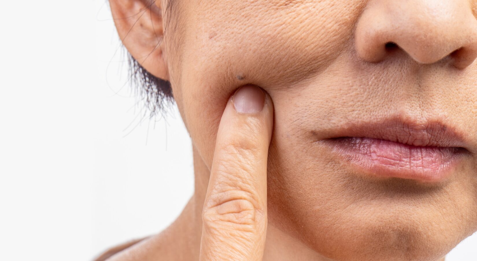 A close-up of a person's cheek with visible fine lines and wrinkles, as they pinch the skin slightly.